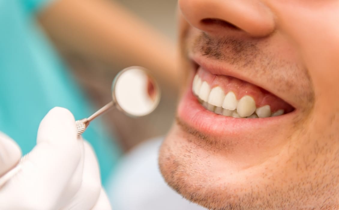 SFP Dental Service Versilia | Igiene e prevenzione