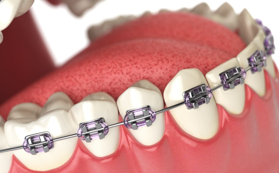 SFP Dental Service Versilia | Ortodonzia